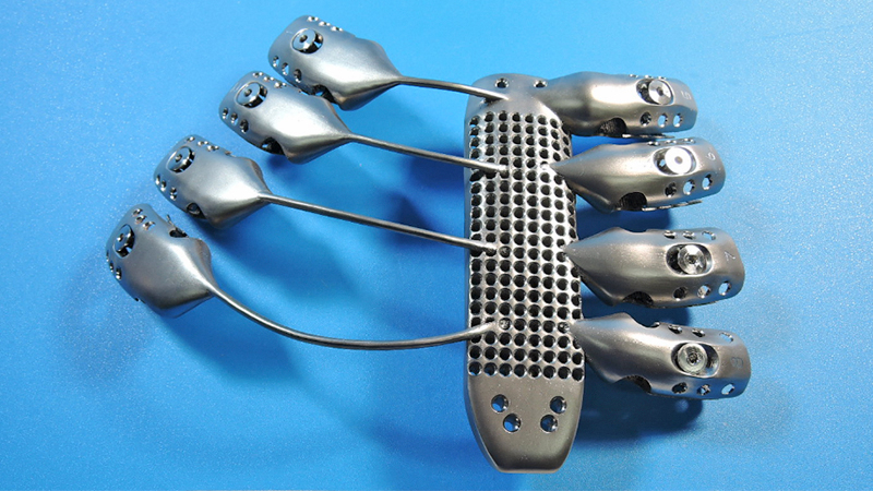 Illustration for article titled The World's First 3D-Printed Titanium Rib Cage Is a Medical Marvel